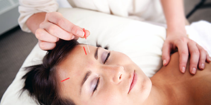 The Acupuncture Breakdown