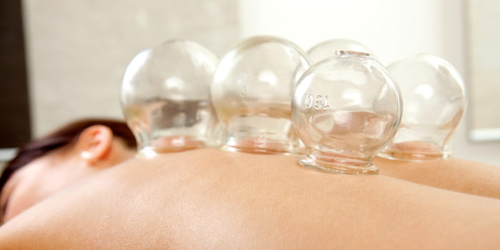 Is Cupping Right for You?