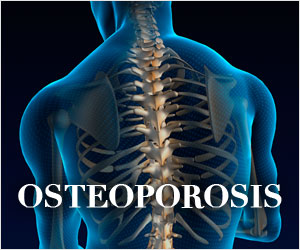Osteoporosis Osteoporosis