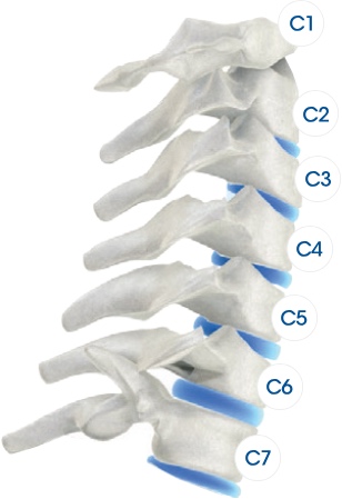 image of a spine showing where the different vertebrae are
