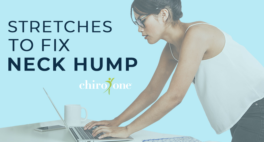 Top Stretches To Fix Neck Hump