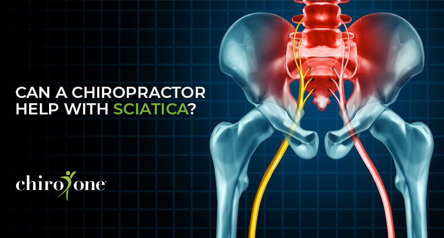 Can A Chiropractor Help with Sciatica?