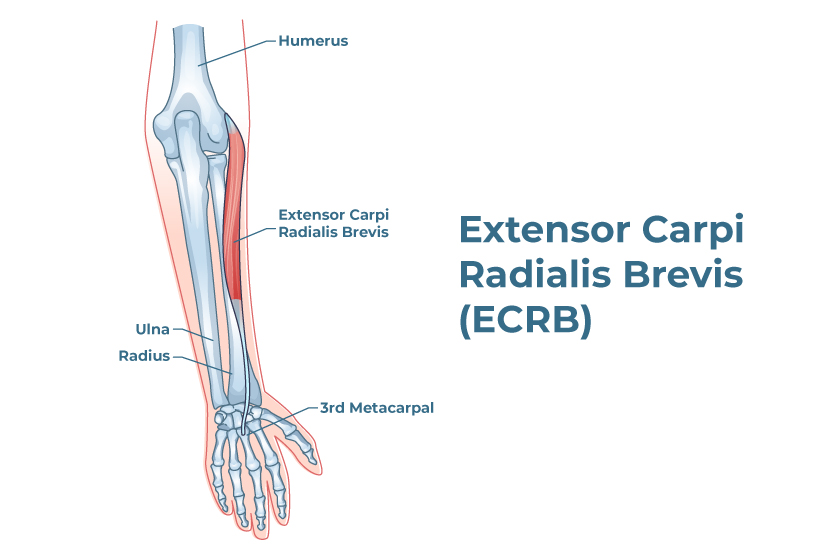 A detailed anatomical illustration focusing on the Extensor Carpi Radialis Brevis (ECRB) muscle.