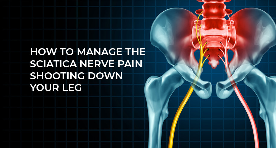 How to manage the sciatica nerve pain shooting down your leg