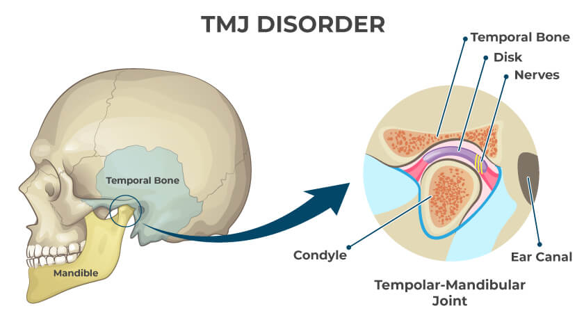 A diagram of the temporomandibular joint which opens and closes the jaw