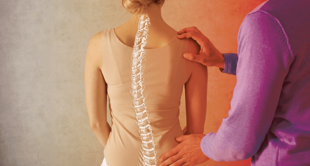 A chiropractor evaluates a patient with scoliosis.