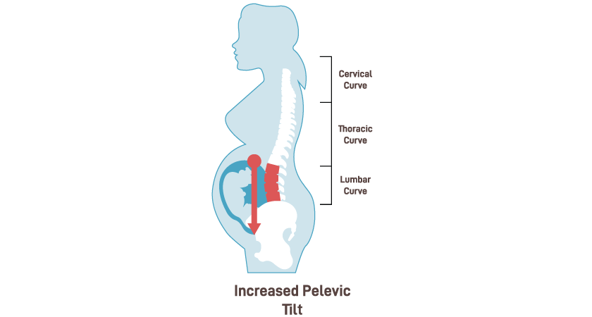 5 Tips for a More Comfortable Pregnancy