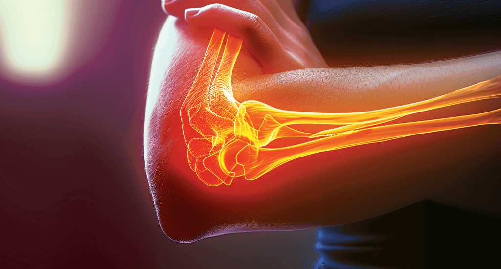 man clutching bicep with graphic overlay of arm bones and joints